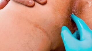 I called the proctologist home to make prostate massage, but it all ended with a hard anal